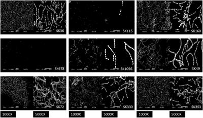 Diversity in Phenotypes Associated With Host Persistence and Systemic Virulence in Streptococcus sanguinis Strains